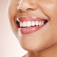 dental-teeth-and-beauty-with-smile-of-woman